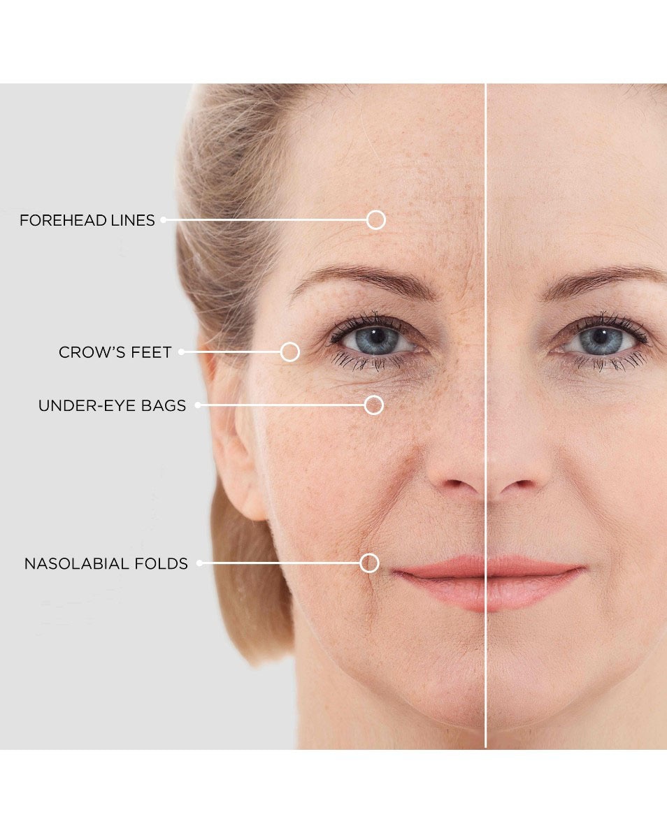 BEAUTICAL INSTANT LIFTING SERUM RÉDUCTION DES RIDES ET RIDULES 15 ML 3