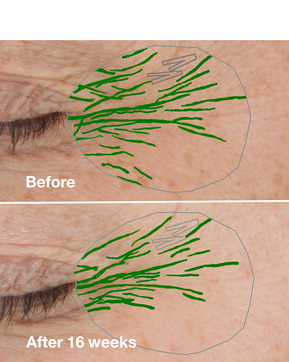 CRÈME HYDRATANTE ANTI-RIDES & ANTI-ÂGE - TOUS TYPES DE PEAUX