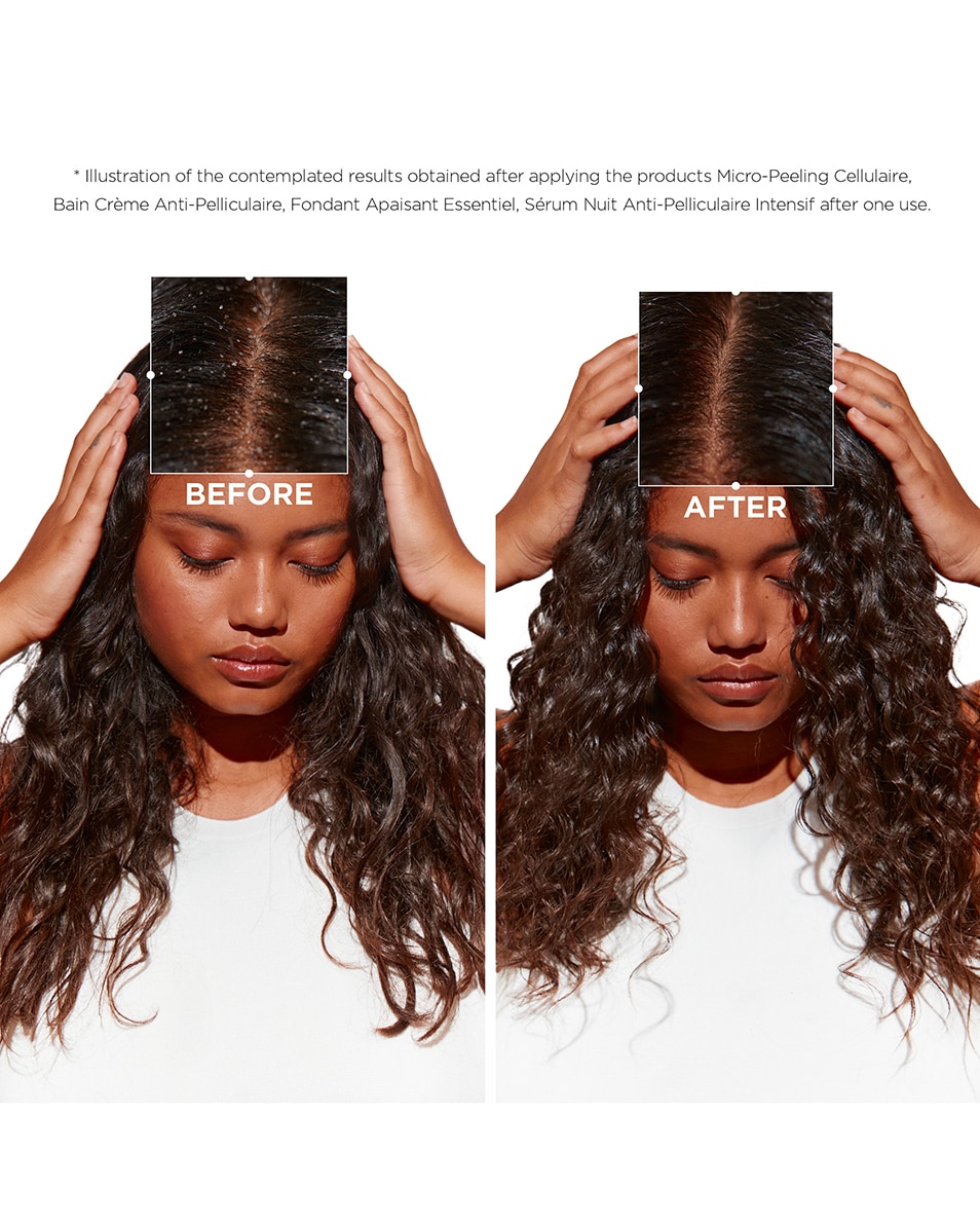 KÉRASTASE SYMBIOSE BAIN CRÈME ANTI-PELLICULAIRE Shampooing Anti-pelliculaire Hydratant Cellulaire 250 ML 3