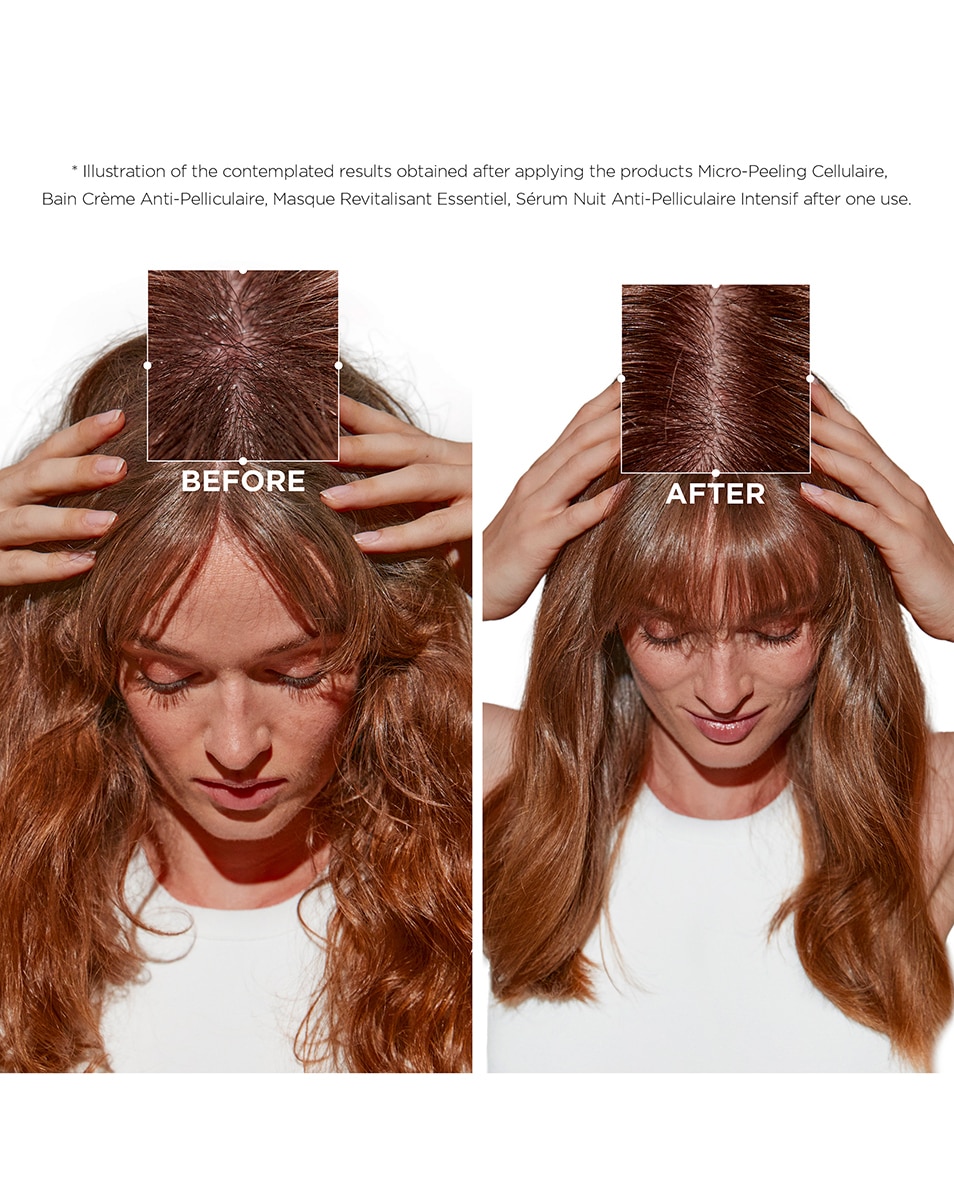 KÉRASTASE SYMBIOSE MASQUE REVITALISANT ESSENTIEL Soin Anti-Pelliculaire Intense 200 ML 3