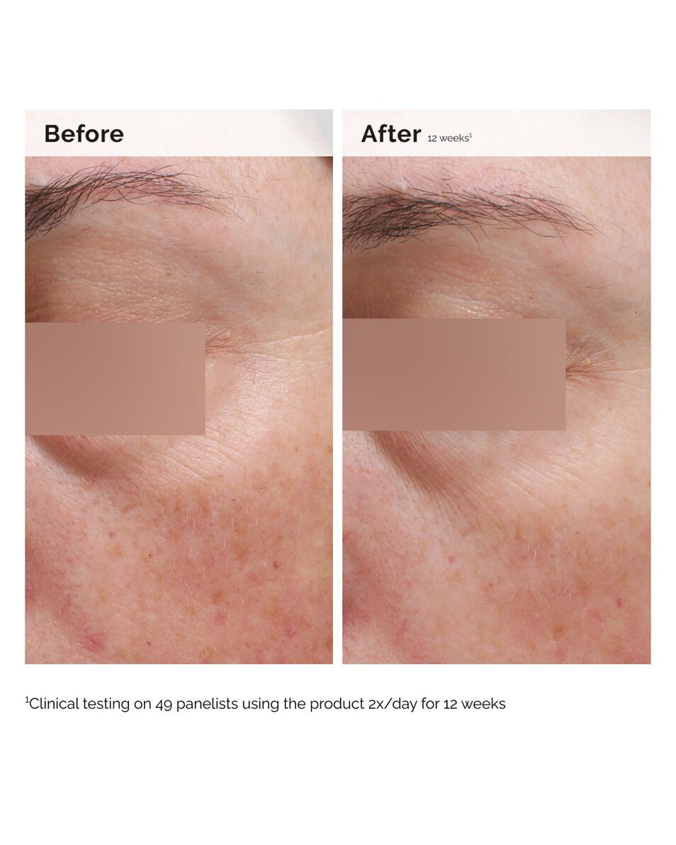 ÉMULSION VISAGE ET CORPS À LA NIACINAMIDE 5%