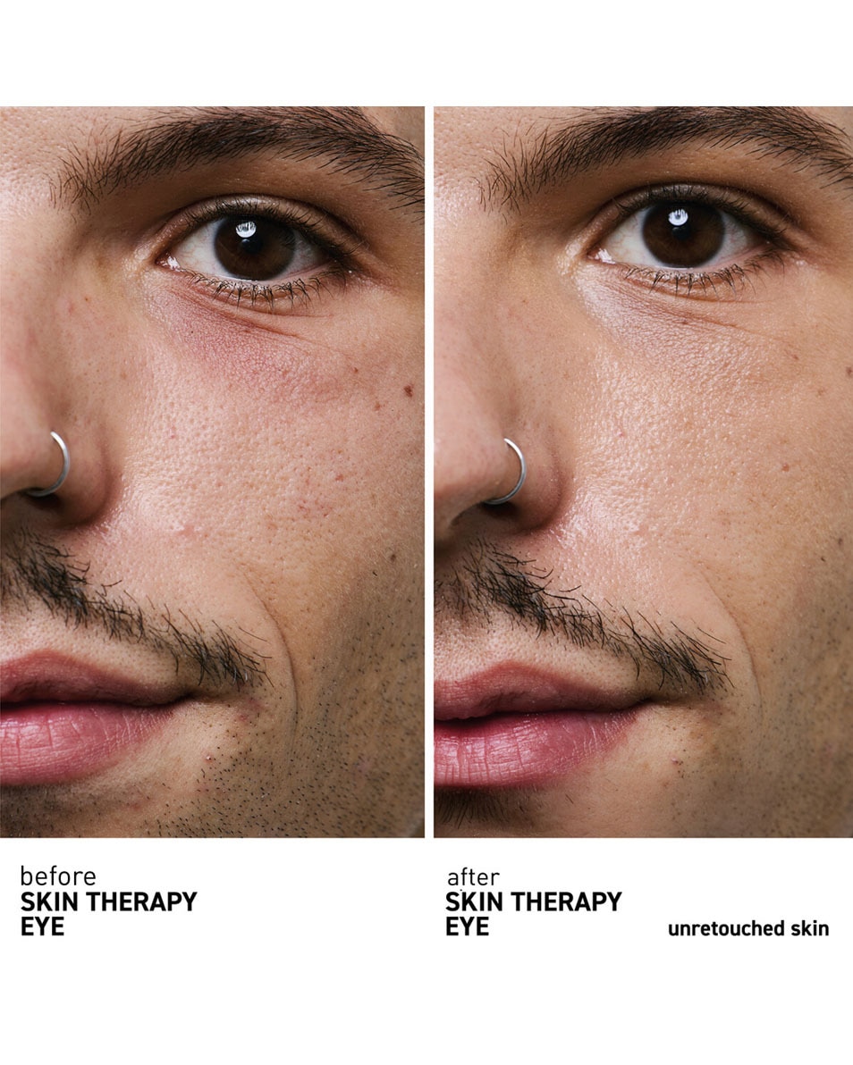 ERBORIAN Skin Therapy Eye Crème yeux multi-perfectrice 15 ML 3