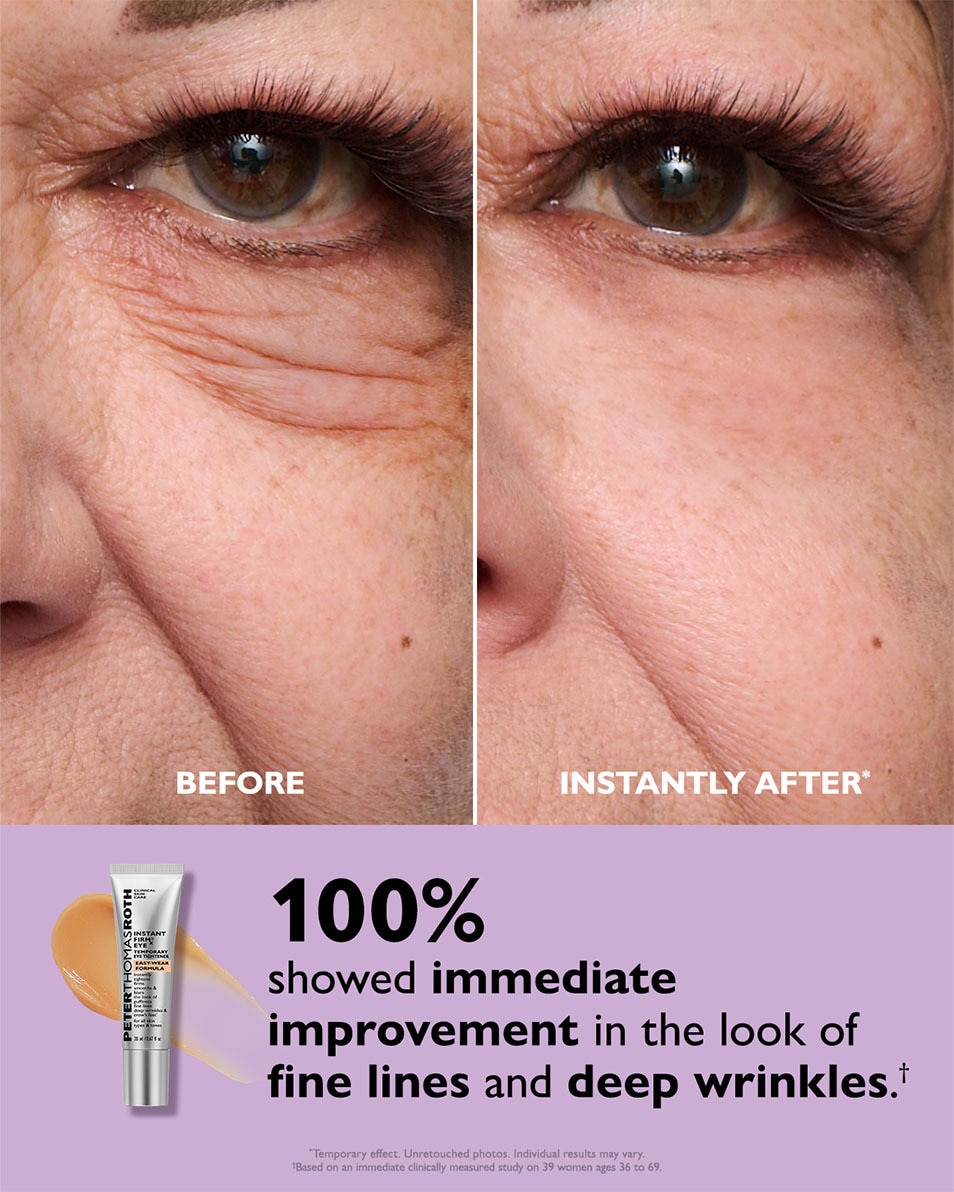 PETER THOMAS ROTH Instant FIRMx Tenseur temporaire instantané pour les yeux 20 ML 3