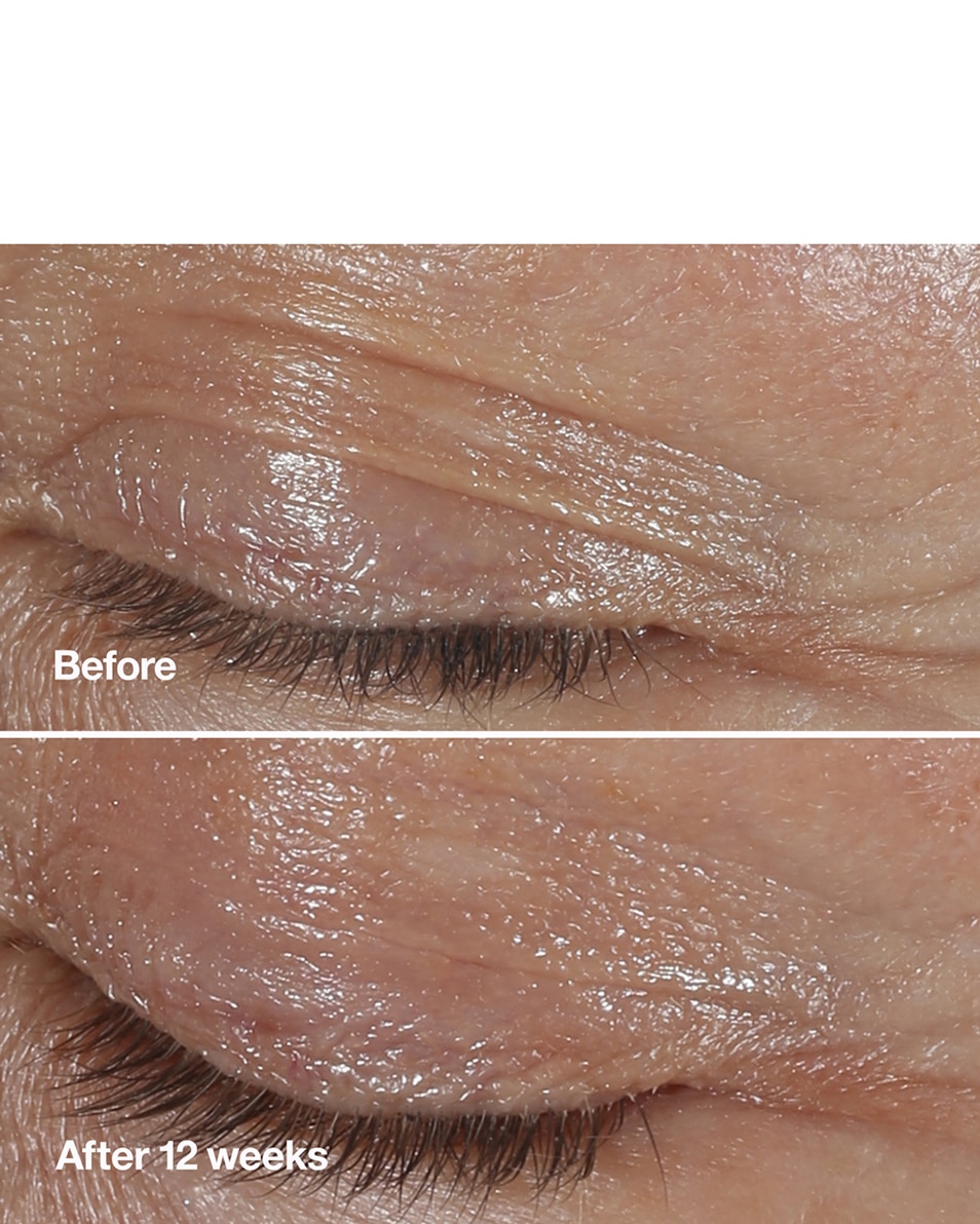 SOIN DES YEUX - ANTI-ÂGE & HYDRATANT - RÉDUIT LES RIDES