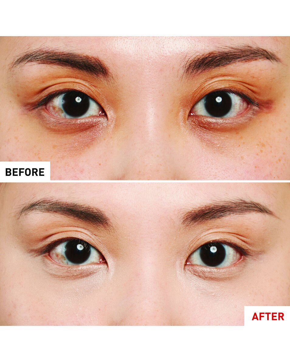 Anticernes-soin couvrant