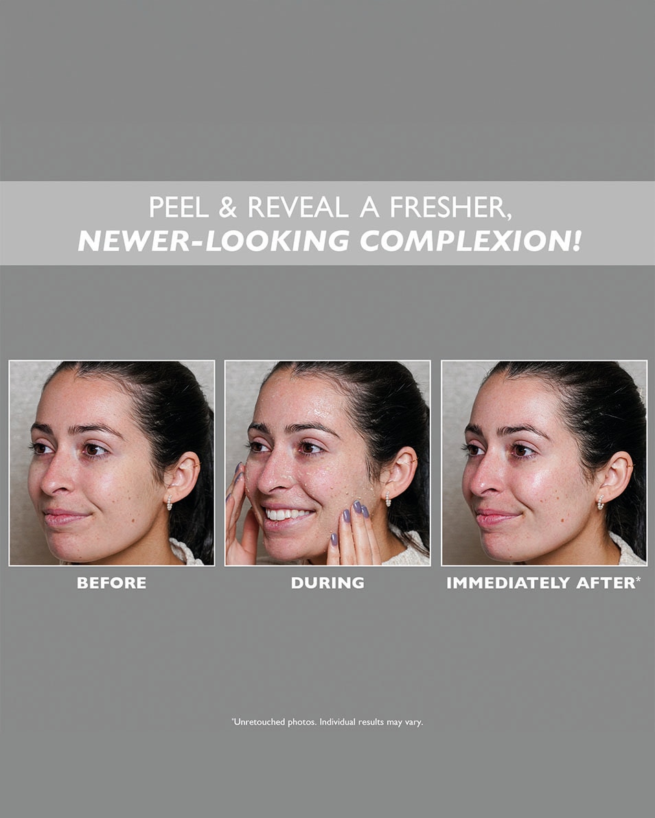 PETER THOMAS ROTH FirmX® Peeling Gel 100 ML 4