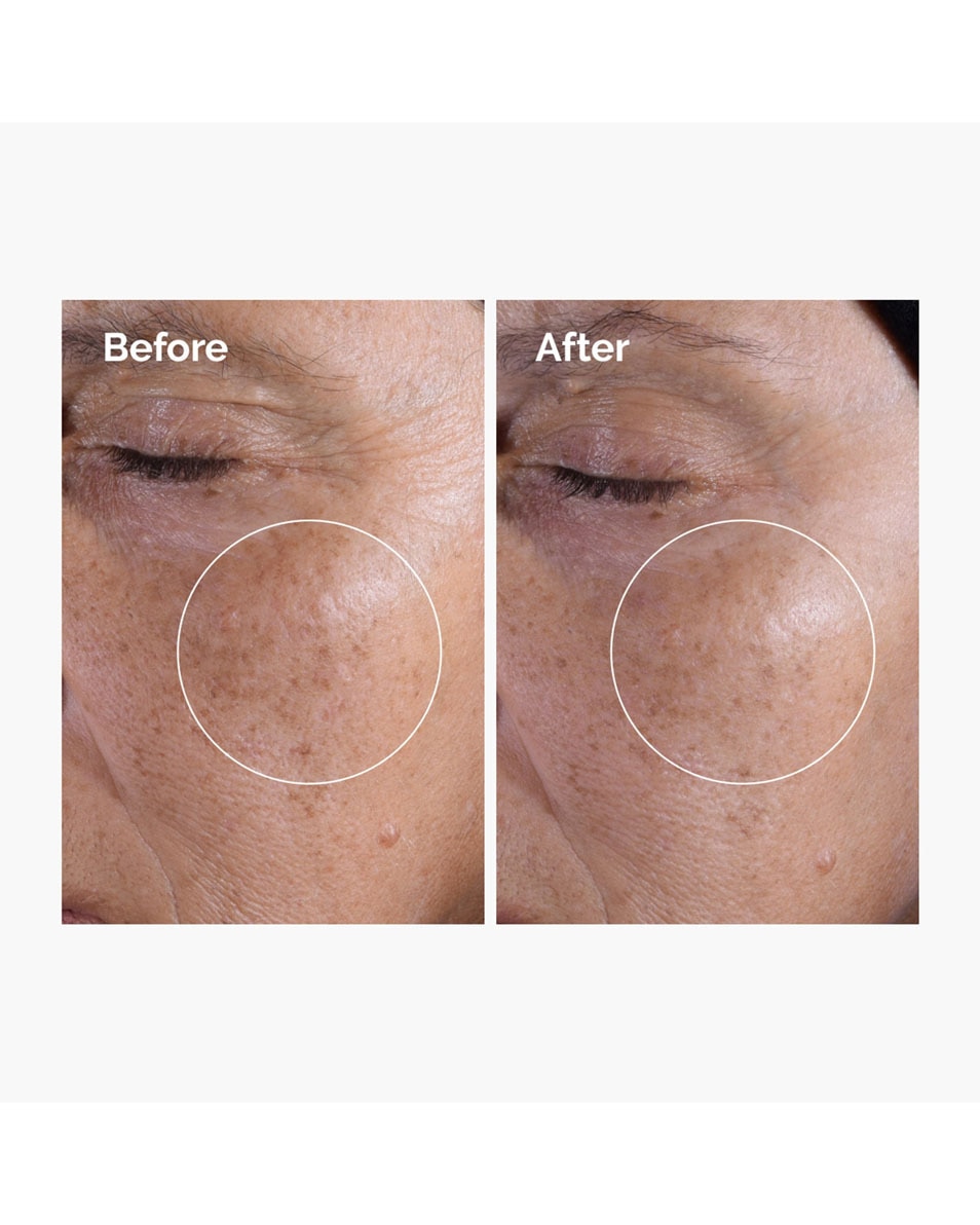 THE ORDINARY Toner Tonique Exfoliant à l'Acide Glycolique 7% 240 ML 4