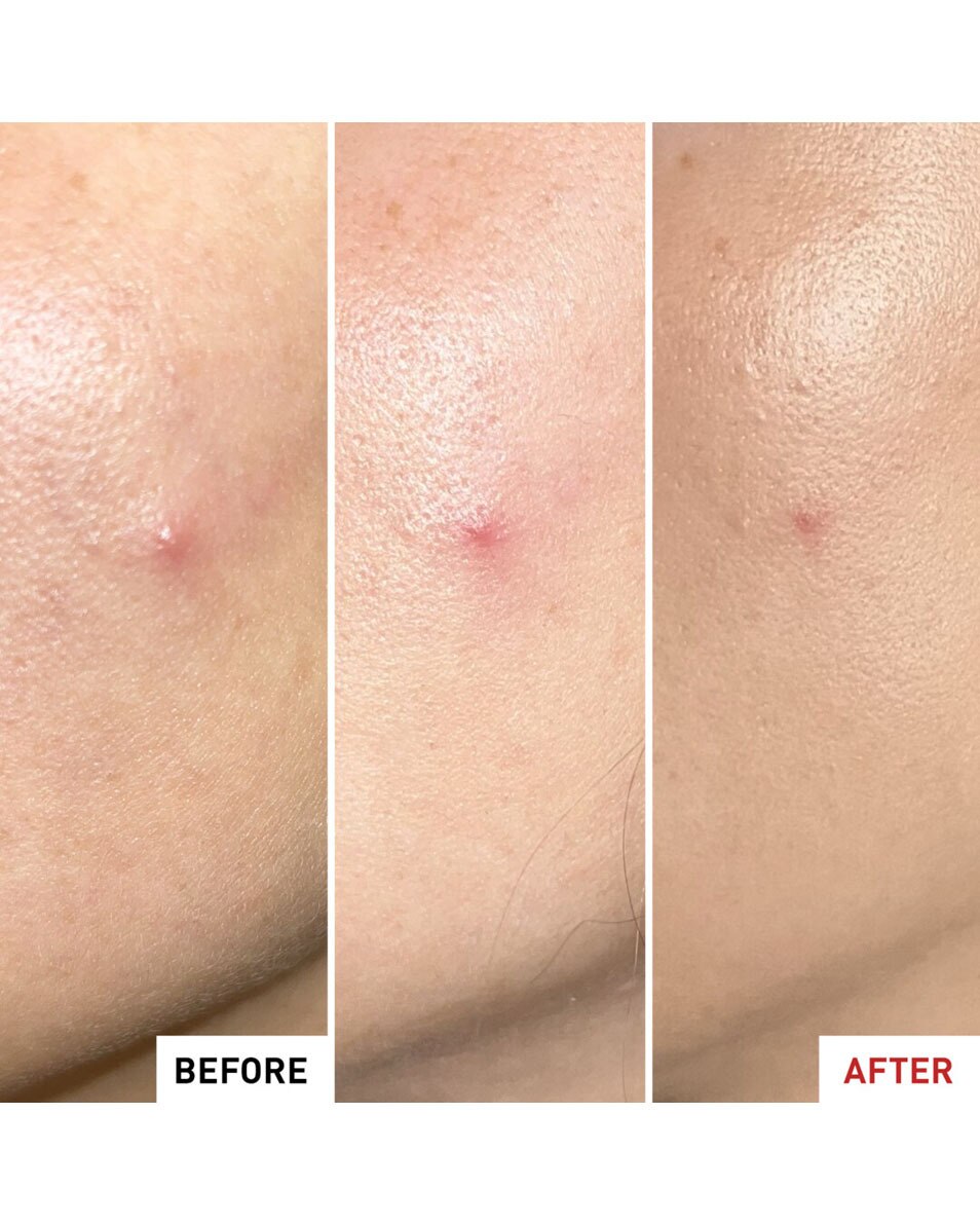 ERBORIAN CENTELLA SOS PATCH GEL EFFET PATCH 9 ML 4