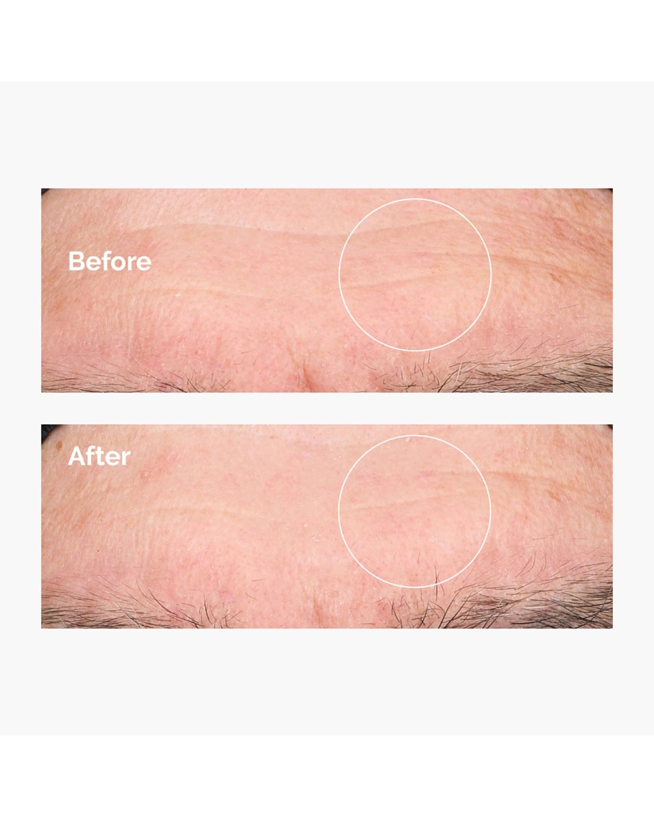 THE ORDINARY Dryness & Dehydratation Acide Hyaluronique 2% + B5 30 ML 4