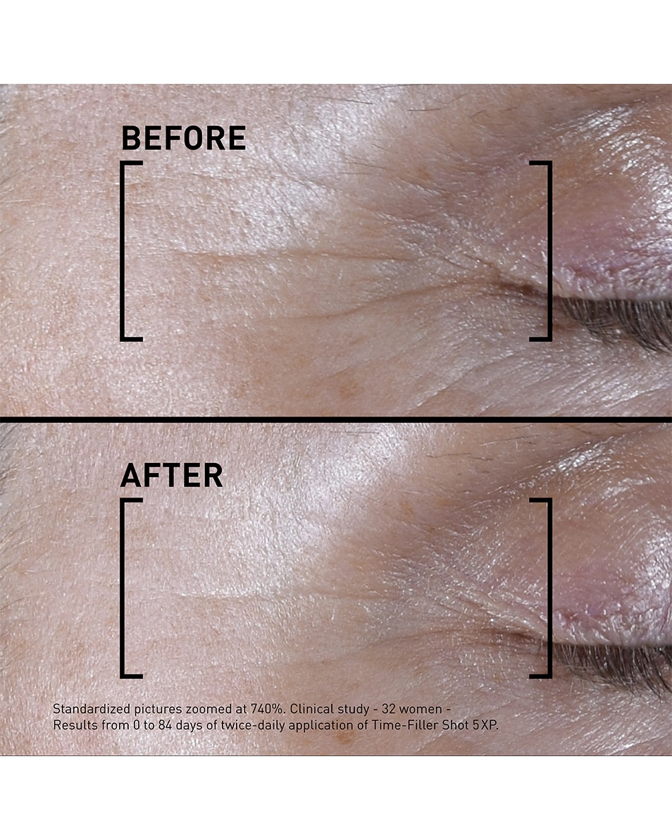 SHOT 5XP Sérum concentré - correction rides d'expression visibles