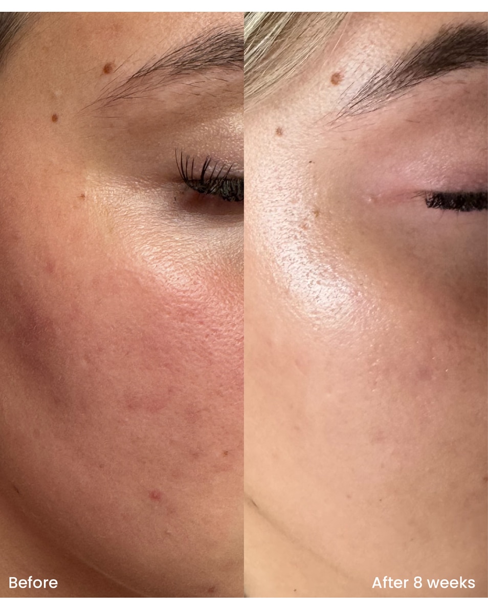 Sérum à la niacinamide