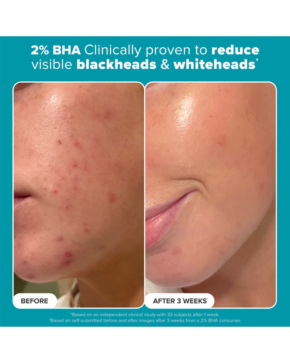 Paula's Choice SKIN PERFECTING SKIN PERFECTING Lotion Exfoliante 2 % BHA 118 ML