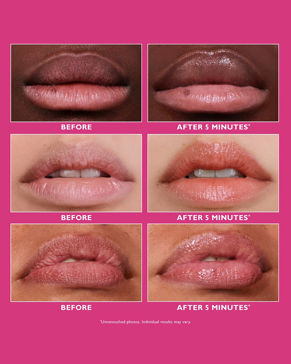 Instant Lipfiller