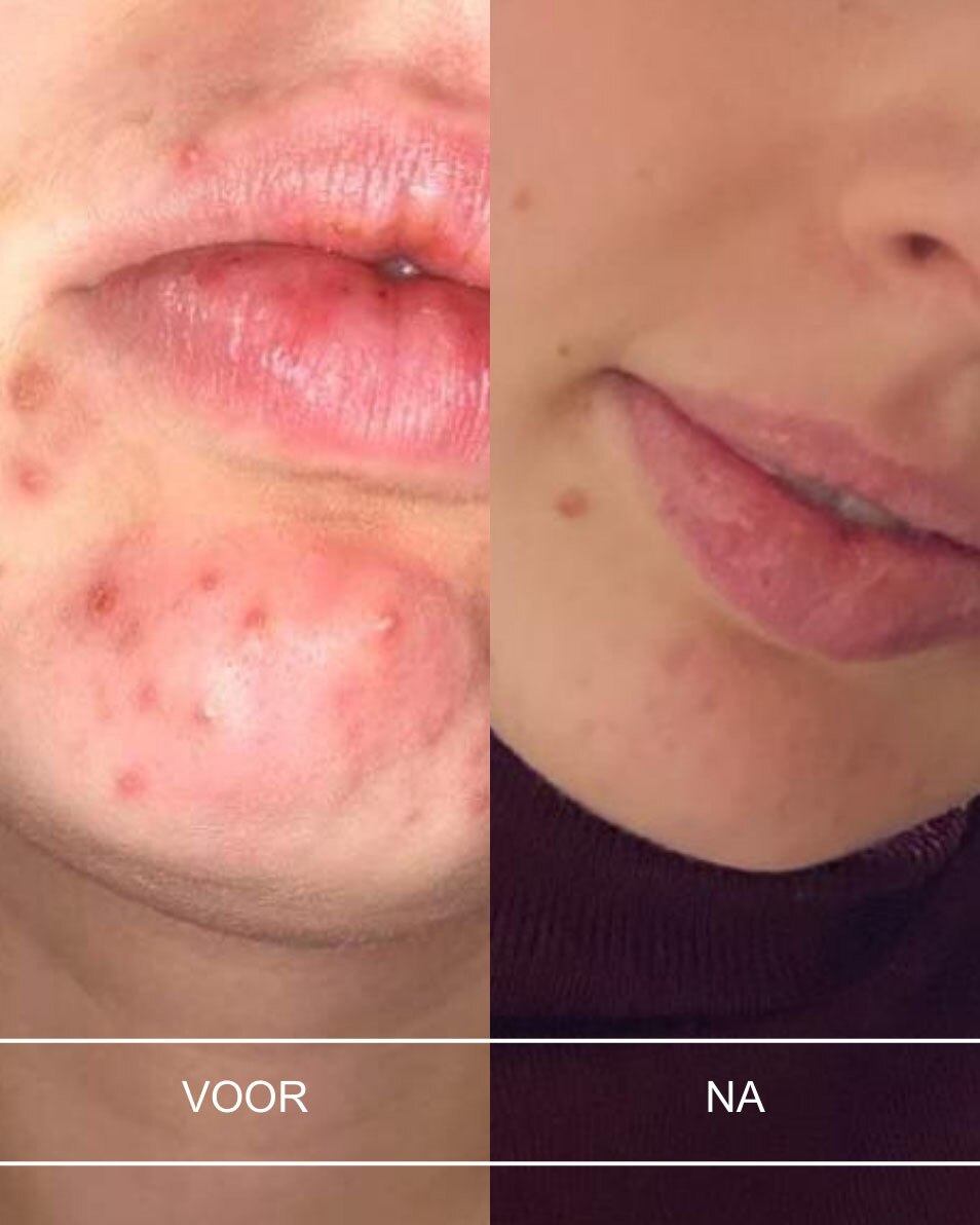 SELF Gently Purifying Facial Cleanser Lait démaquillant - visage & yeux 200 ML 5