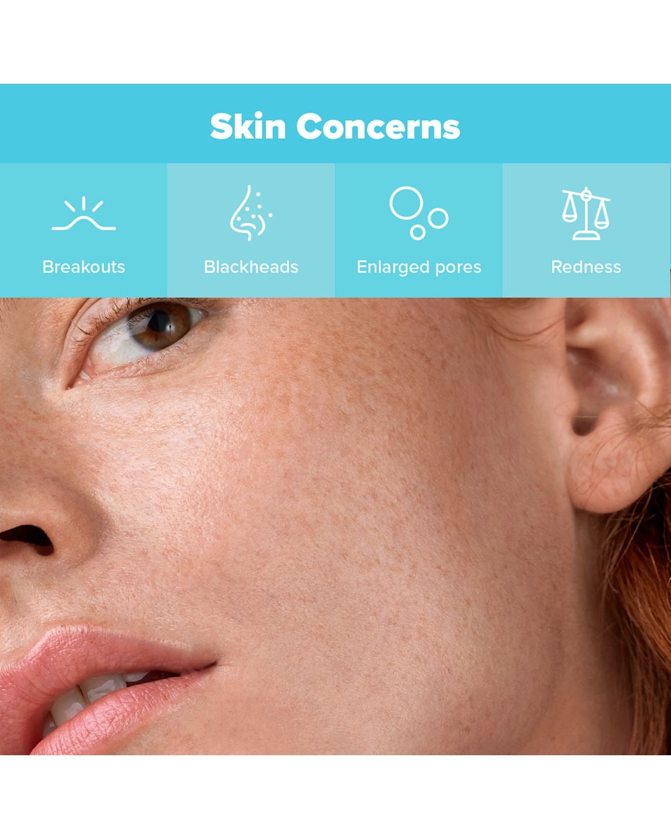 Paula's Choice MINI-KIT Kit Best-Sellers Anti-Imperfections 3 ST 5