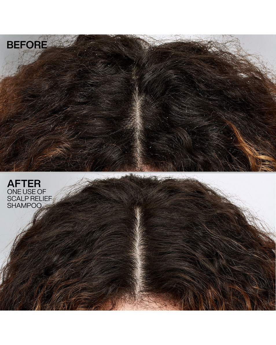 Shampooing antipelliculaire - pour cheveux secs