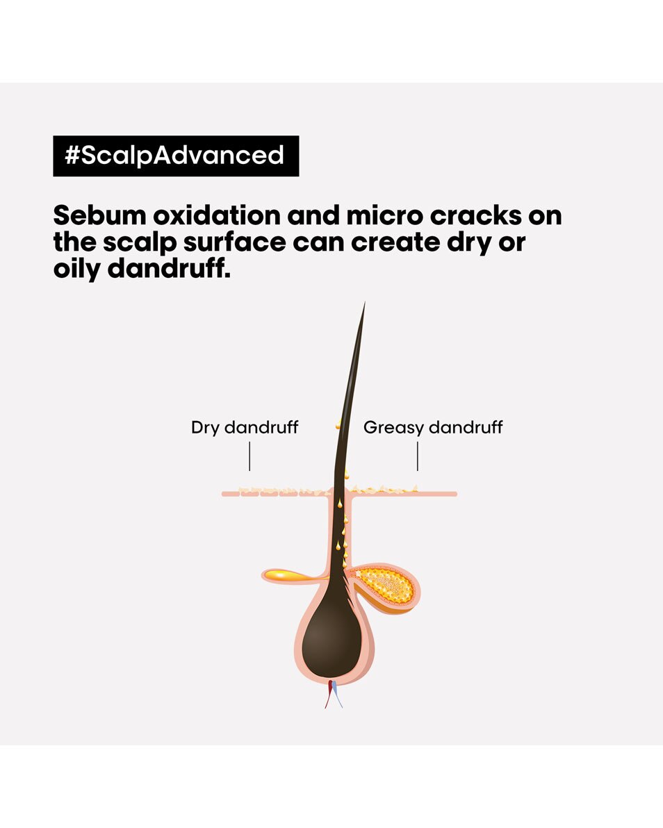 L'OREAL PROFESSIONNEL Scalp Advanced Shampooing dermo-clarifiant antipelliculaire 300 ML 2