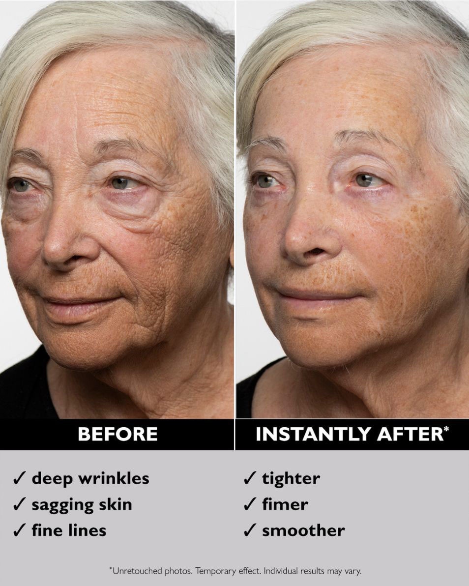 Gel raffermissant temporaire pour le visage